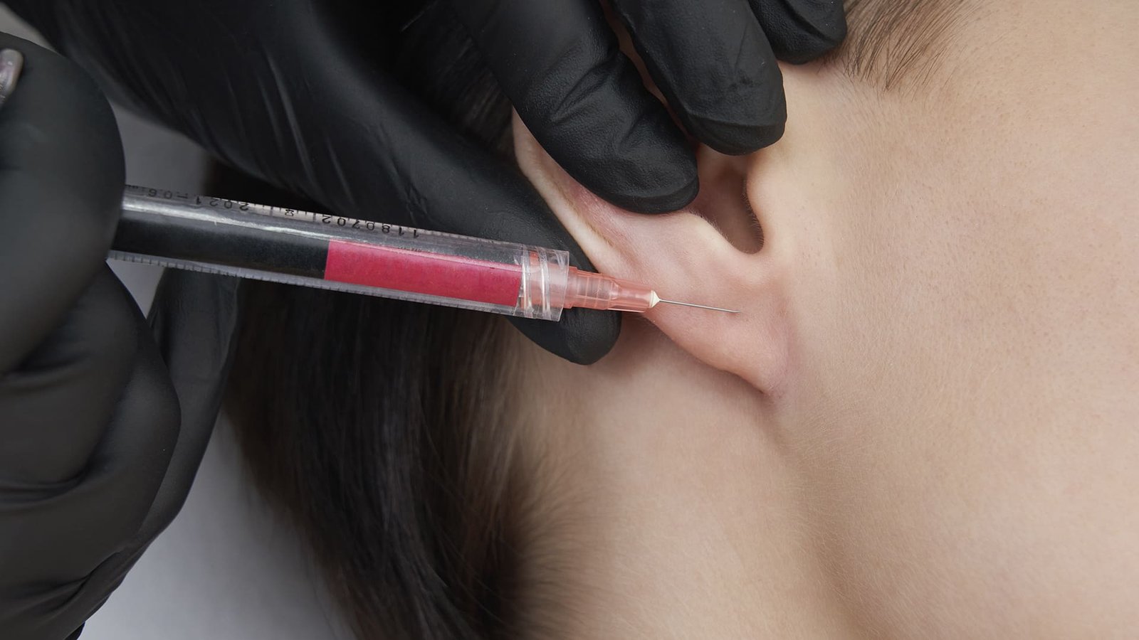 Escuela medicina estética